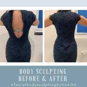 Facial & Body Sculpting by Monika