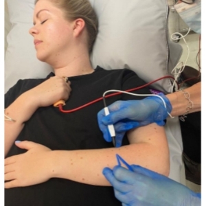 Hair Removal Specialists Surrey