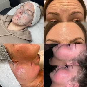 AHT Aesthetics and Skincare
