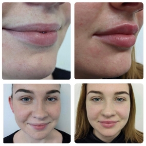 Elite Skin Clinic - Cobham & Harley Street