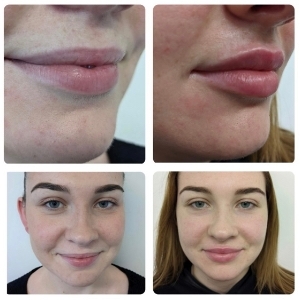 Elite Skin Clinic - Cobham & Harley Street