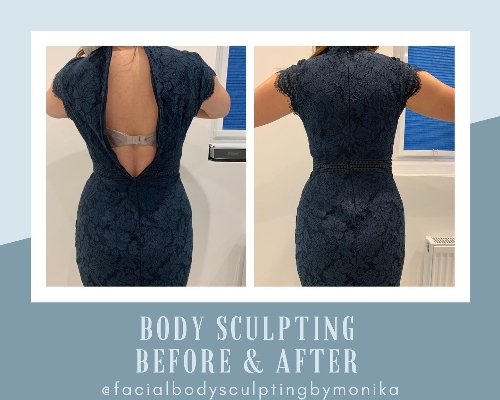 Facial & Body Sculpting by Monika