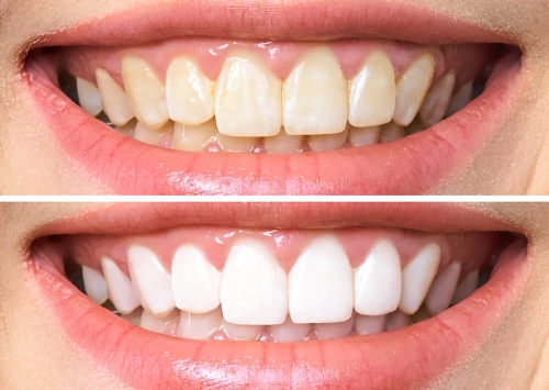 Image 1 from Hampshire Dental Care