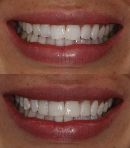 Gallery image: 74150_2.jpg 