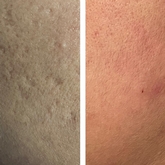 Thumbnail image 1 from Elite Skin Clinic - Cobham & Harley Street