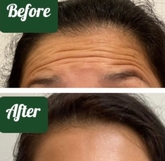 Thumbnail image 2 from Elite Skin Clinic - Cobham & Harley Street