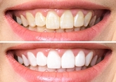 Thumbnail image 1 from Hampshire Dental Care